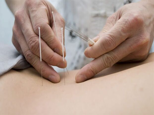 akupunktura na zapalenie prostaty