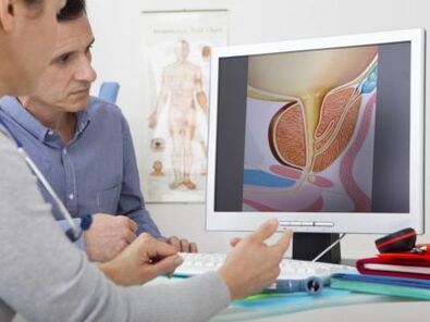 Urolog konsultuje z pacjentem zapalenie gruczołu krokowego i metody jego leczenia.
